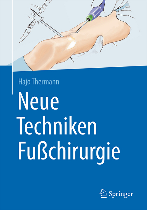 Neue Techniken Fußchirurgie - Hajo Thermann