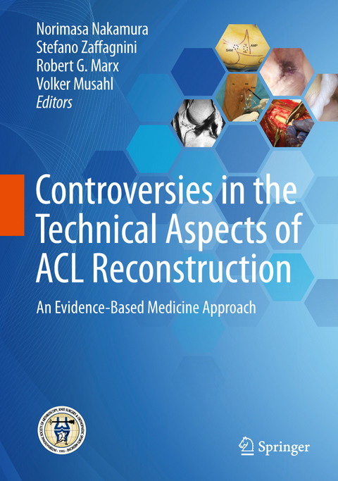 Controversies in the Technical Aspects of ACL Reconstruction - 