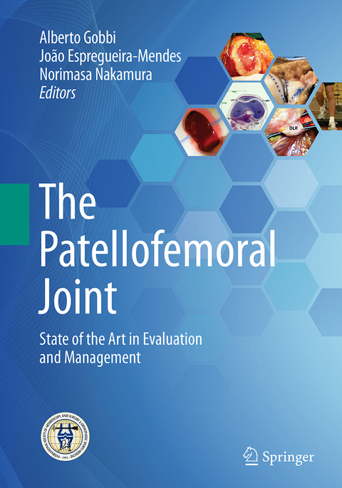 The Patellofemoral Joint - 