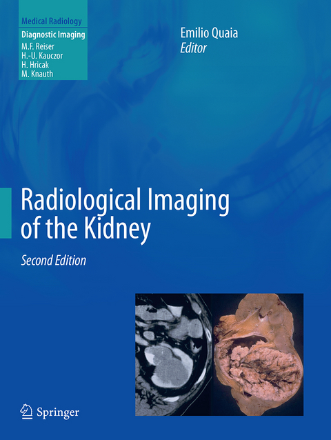 Radiological Imaging of the Kidney - 