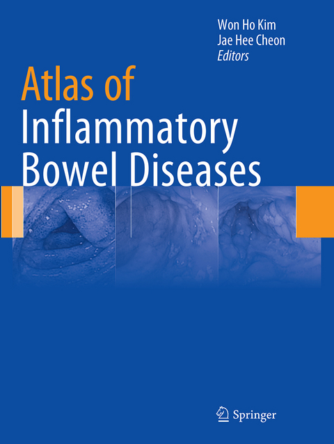 Atlas of Inflammatory Bowel Diseases - 