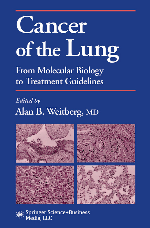 Cancer of the Lung - 