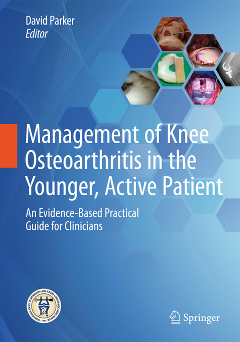 Management of Knee Osteoarthritis in the Younger, Active Patient - 