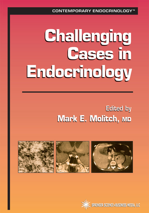 Challenging Cases in Endocrinology - 