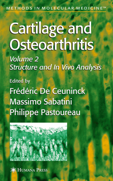 Cartilage and Osteoarthritis - 