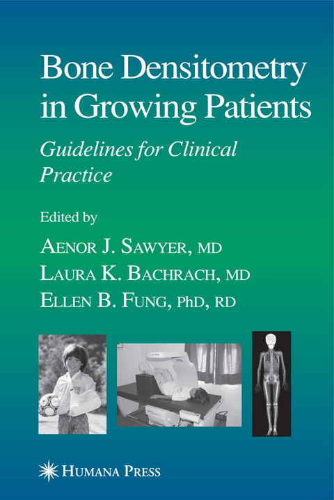 Bone Densitometry in Growing Patients - 