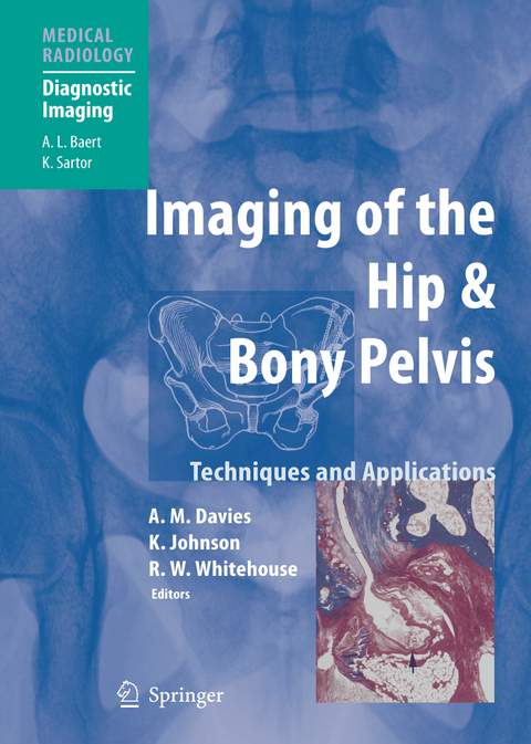 Imaging of the Hip & Bony Pelvis - 