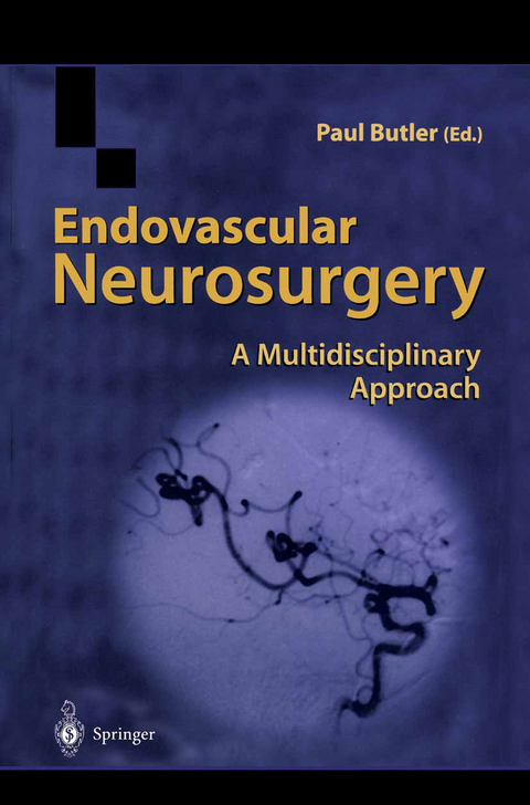 Endovascular Neurosurgery - 