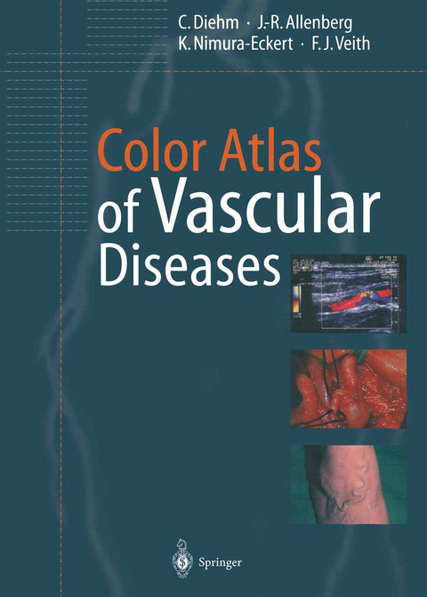 Color Atlas of Vascular Diseases - C. Diehm, J.-R. Allenberg, K. Nimura-Eckert, F.J. Veith