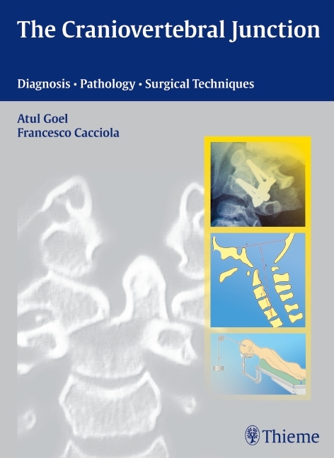 The Craniovertebral Junction - 