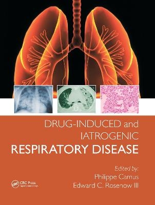 Drug-induced and Iatrogenic Respiratory Disease - Phillipe Camus, Edward Rosenow III