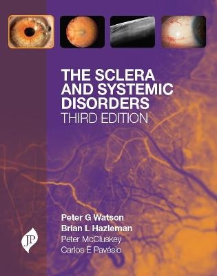 The Sclera and Systemic Disorders - Peter G Watson, Brian L Hazleman, Carlos E Pavesio, Peter M McCluskey