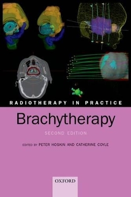 Radiotherapy in Practice - Brachytherapy - 