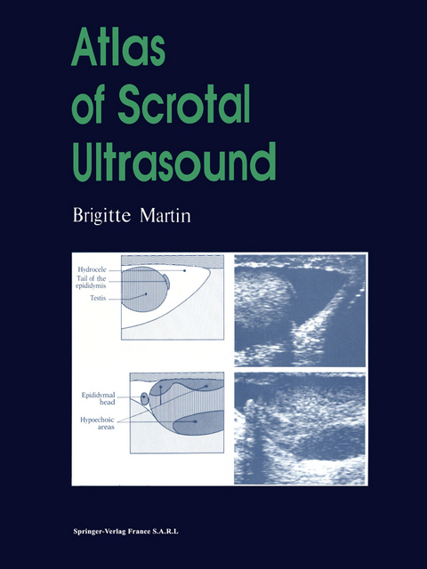 Atlas of Scrotal Ultrasound - Brigitte Martin