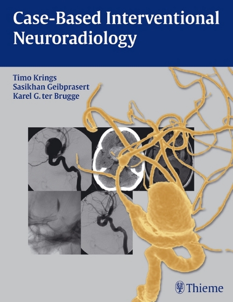 Case-Based Interventional Neuroradiology - Timo Krings, Sasikhan Geibprasert, Karel ter Brugge