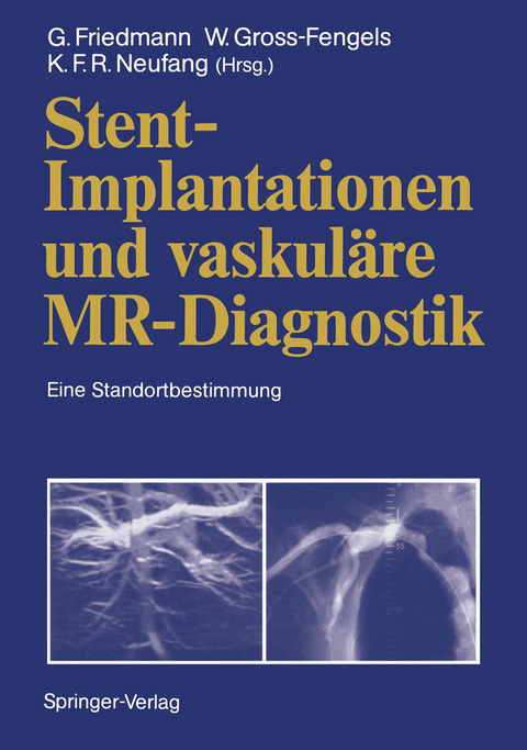 Stent-Implantationen und vaskuläre MR-Diagnostik - 