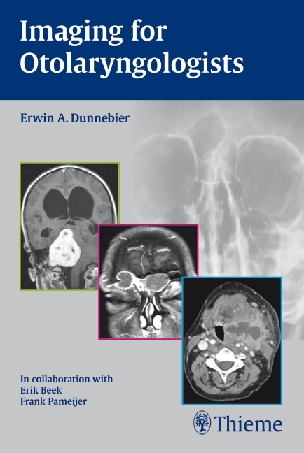 Imaging for Otolaryngologists - Erwin A. Dunnebier