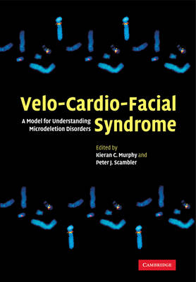 Velo-Cardio-Facial Syndrome - 