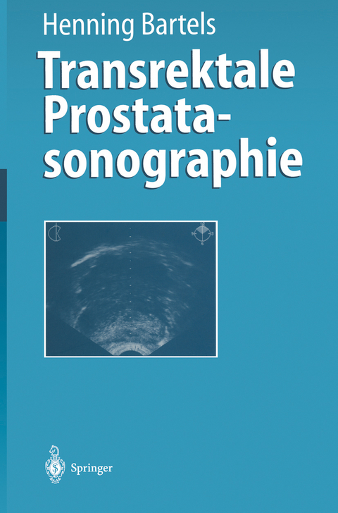 Transrektale Prostatasonographie - Henning Bartels