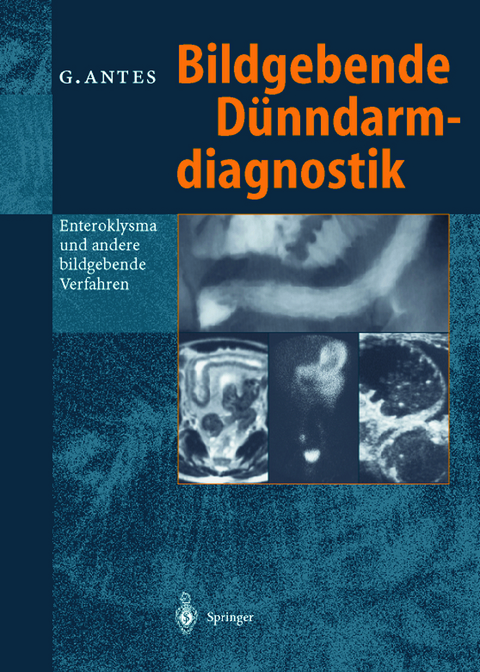 Bildgebende Dünndarmdiagnostik - Günther Antes