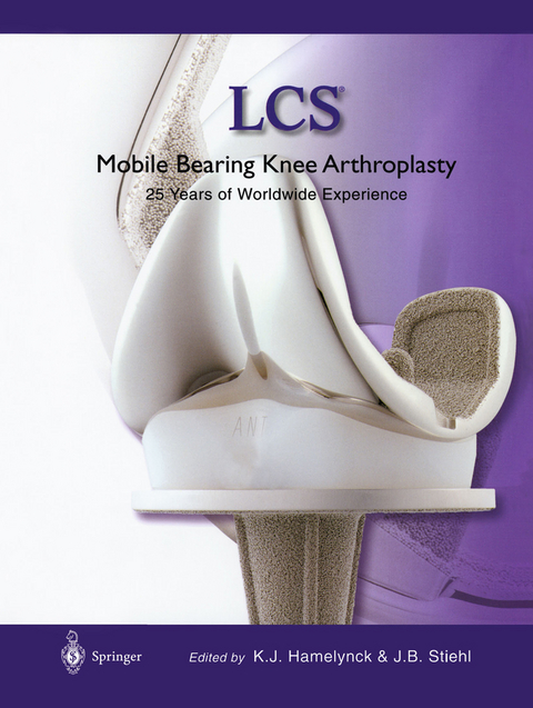 LCS® Mobile Bearing Knee Arthroplasty - 