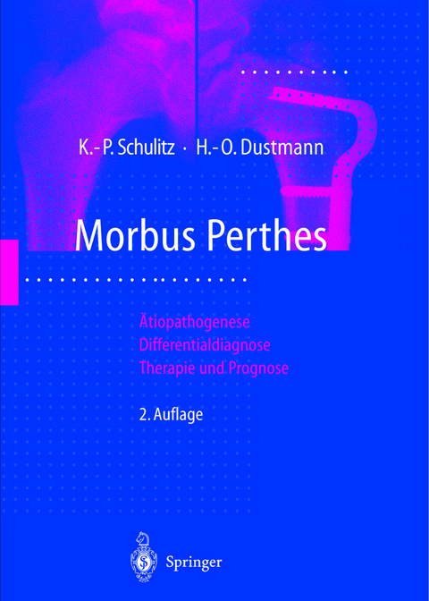 Morbus Perthes - Klaus-Peter Schulitz, Hans-Otto Dustmann