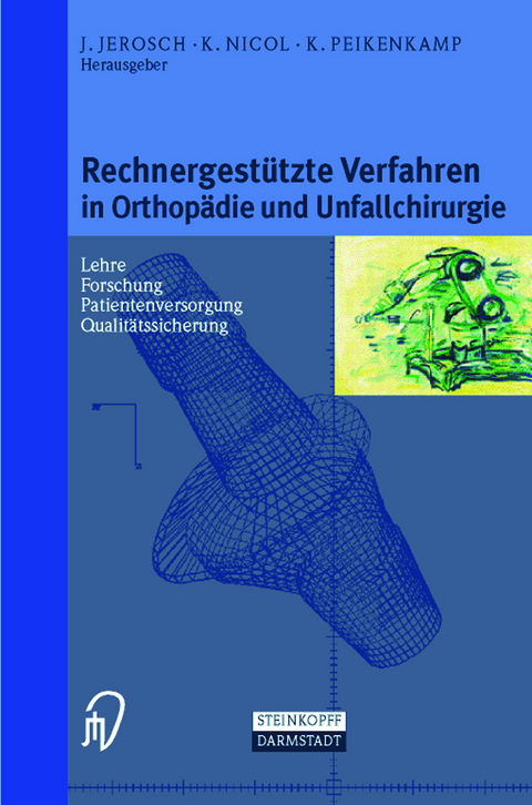 Rechnergestützte Verfahren in Orthopädie und Unfallchirurgie - 