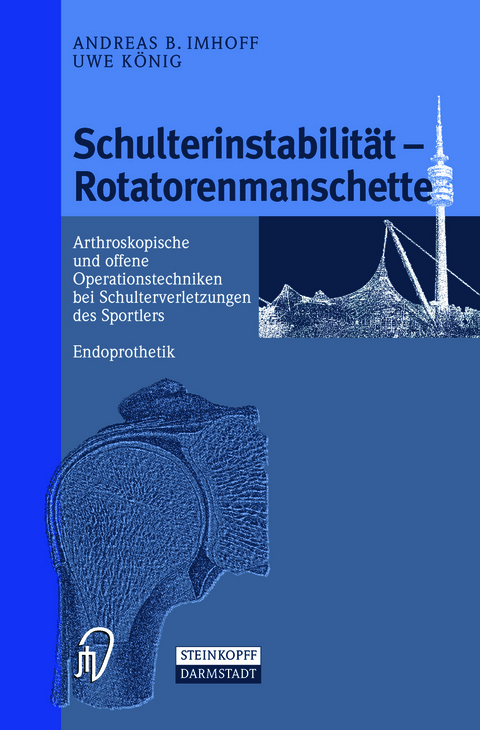 Schulterinstabilität — Rotatorenmanschette - 