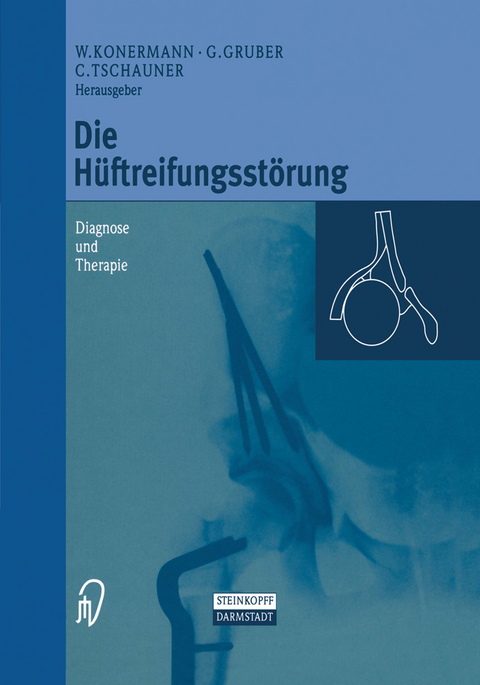 Die Hüftreifungsstörung - 