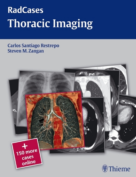 Radcases Thoracic Imaging - Michael Galanski