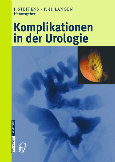 Komplikationen in der Urologie - 