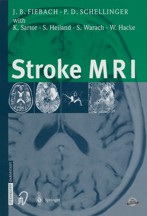 Stroke MRI - Jochen Fiebach, Peter Schellinger