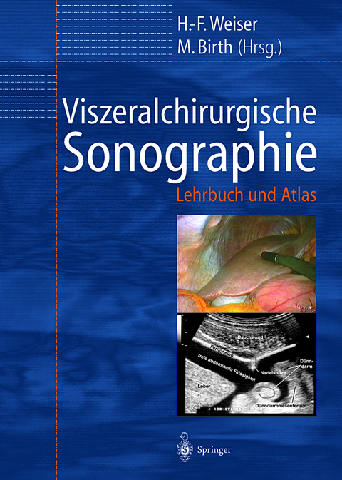 Viszeralchirurgische Sonographie - 