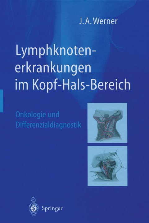 Lymphknotenerkrankungen im Kopf-Hals-Bereich - Jochen A. Werner