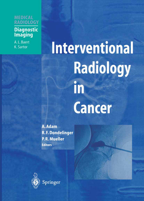 Interventional Radiology in Cancer - 