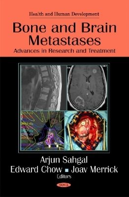 Bone & Brain Metastases - 