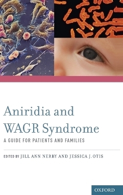 Aniridia and WAGR Syndrome - 