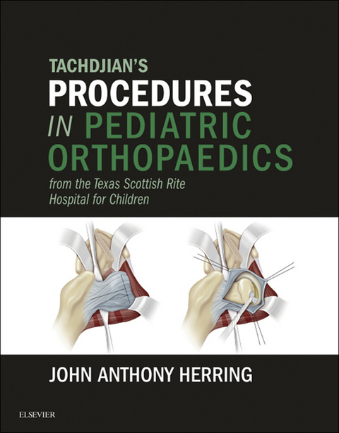 Tachdjian's Procedures in Pediatric Orthopaedics - John A. Herring