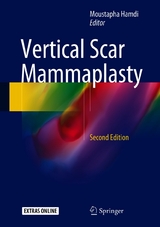 Vertical Scar Mammaplasty - 