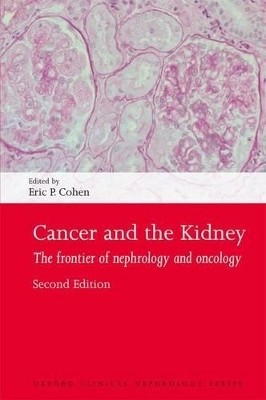 Cancer and the Kidney - 