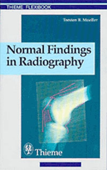 Normal Findings in Radiography - Torsten Bert Moeller