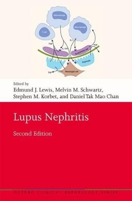 Lupus Nephritis - 