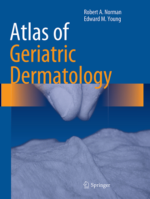 Atlas of Geriatric Dermatology - Robert A. Norman, Jr Young  Edward M.