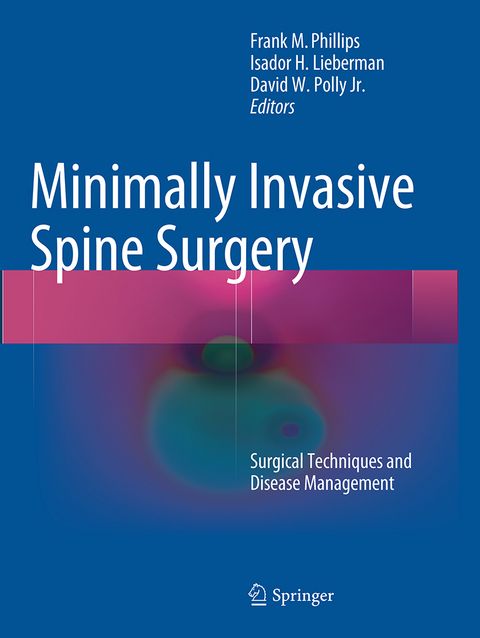 Minimally Invasive Spine Surgery - 