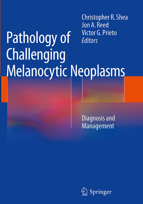 Pathology of Challenging Melanocytic Neoplasms - 