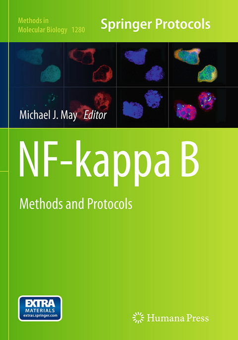 NF-kappa B - 