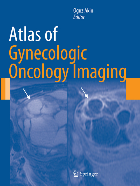 Atlas of Gynecologic Oncology Imaging - 