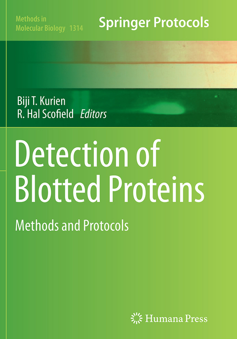 Detection of Blotted Proteins - 