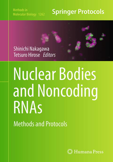 Nuclear Bodies and Noncoding RNAs - 