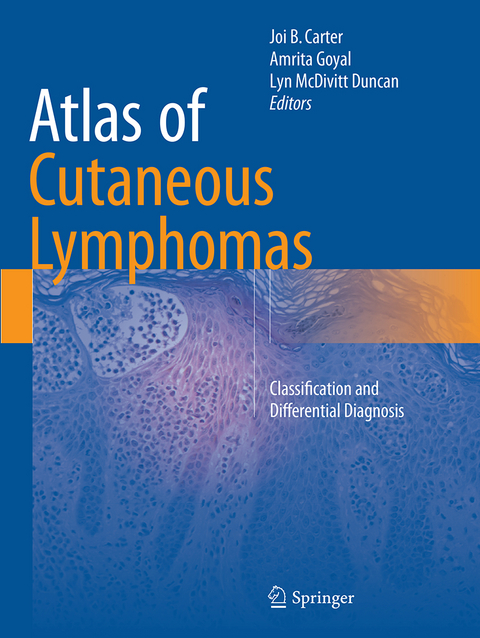 Atlas of Cutaneous Lymphomas - 